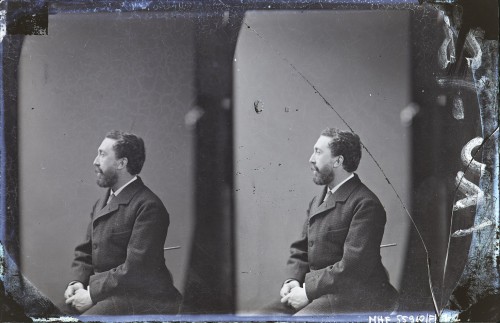 Klisza z dwiema klatkami. Mężczyzna w wieku około 37 lat, siedzący, zwrócony w lewo, ujęty do kolan.